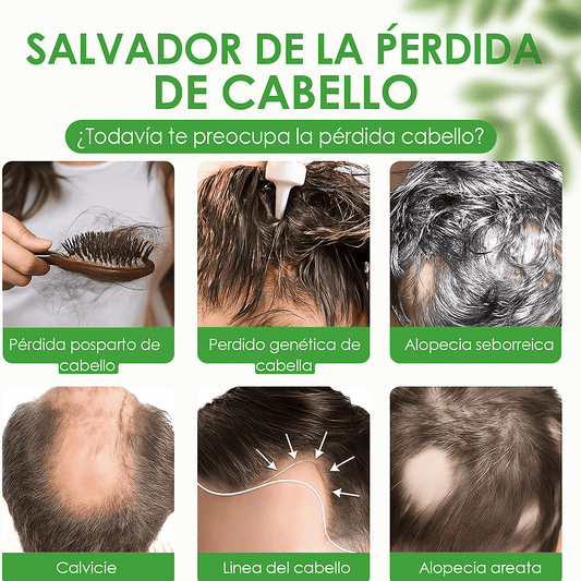 Spray de Crecimiento del Cabello- Detén la caida